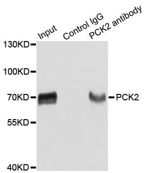 Polyclonal Rabbit anti-Human PCK2 / PEPCK Antibody (WB)