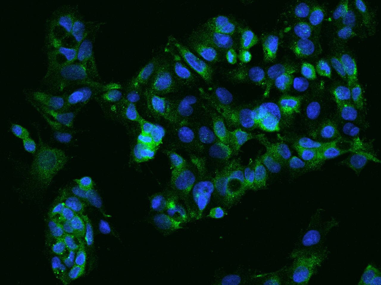 SDC2 / Syndecan 2 Antibody