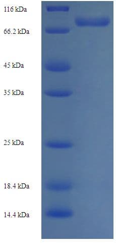 Human UGDH / UDPGDH Protein (Recombinant His-SUMO)