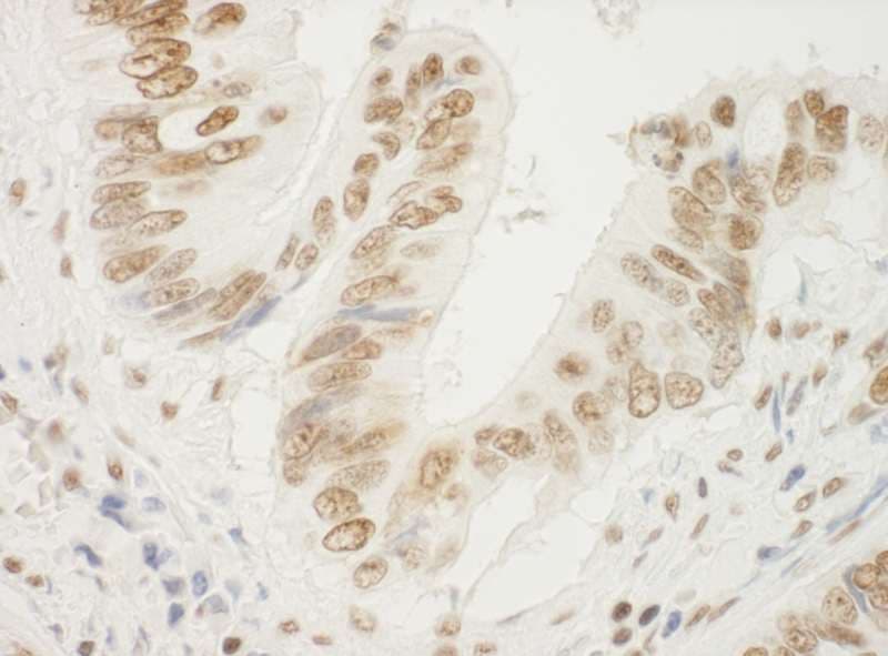 NPM1 / NPM / Nucleophosmin Antibody (aa250-294)