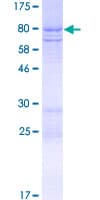 Human PDZD7 Protein (Recombinant GST)