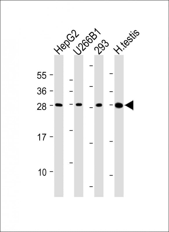 Polyclonal Rabbit anti-Human CLEC1B / CLEC-2 Antibody (N-Terminus, WB)