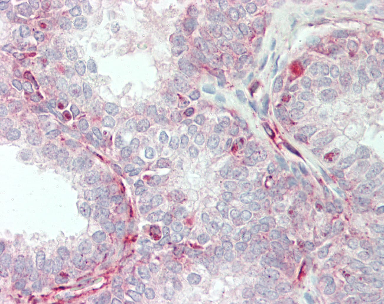 Polyclonal Rabbit anti-Human TRIP / LRRFIP1 Antibody (aa35-84, IHC, WB)