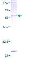 Human PORCN Protein (Recombinant GST)