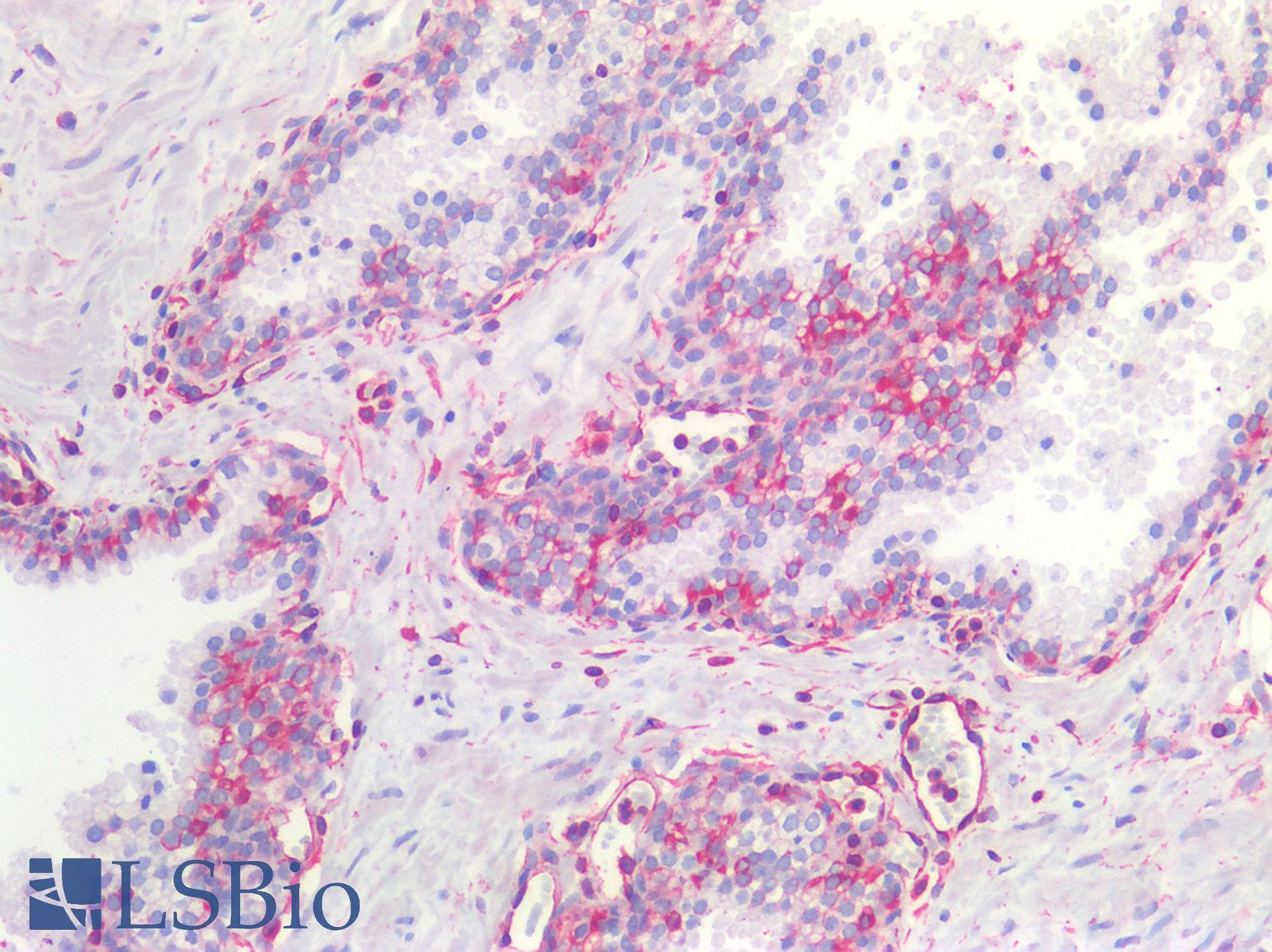 PathPlus™ NOS2 / iNOS Antibody