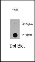 EP300 / p300 Antibody (phospho-Ser89)