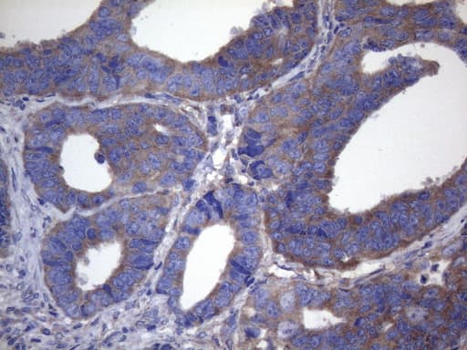 CYTH2 / Cytohesin 2 Antibody (clone OTI4D9)