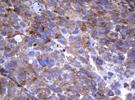 CD30 Antibody (clone OTI16H5)