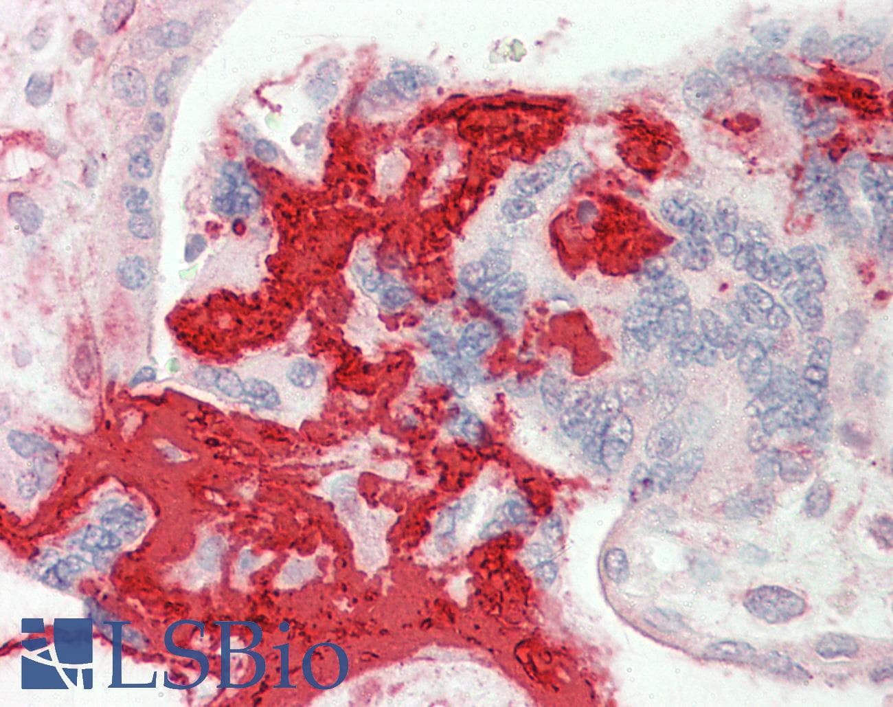 IHC-plus™ FGB / Fibrinogen Beta Chain Antibody (aa177-190)