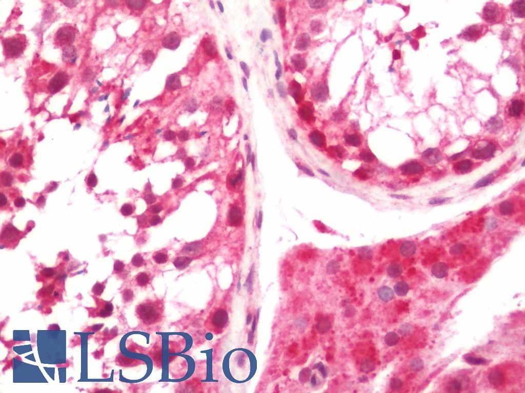IHC-plus™ DTWD1 Antibody