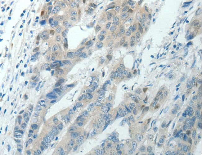 RNF126 Antibody