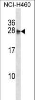 Polyclonal Rabbit anti-Human MOCS2 Antibody (aa14-43, WB)