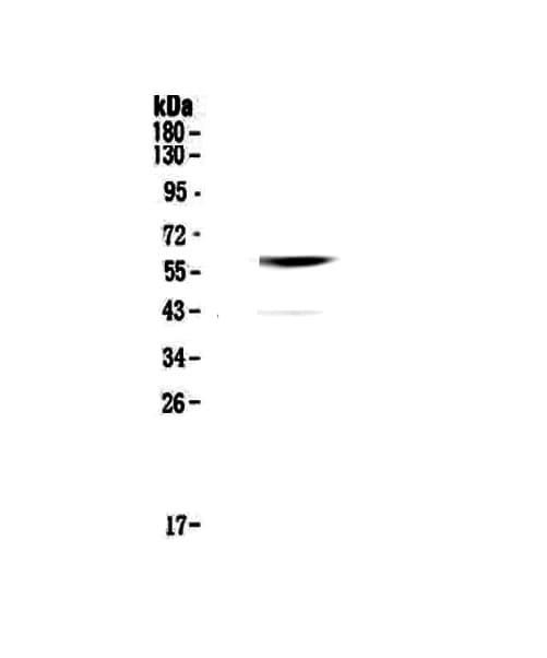 Polyclonal Rabbit anti-Human CNR1 / CB1 Antibody (IHC, WB)