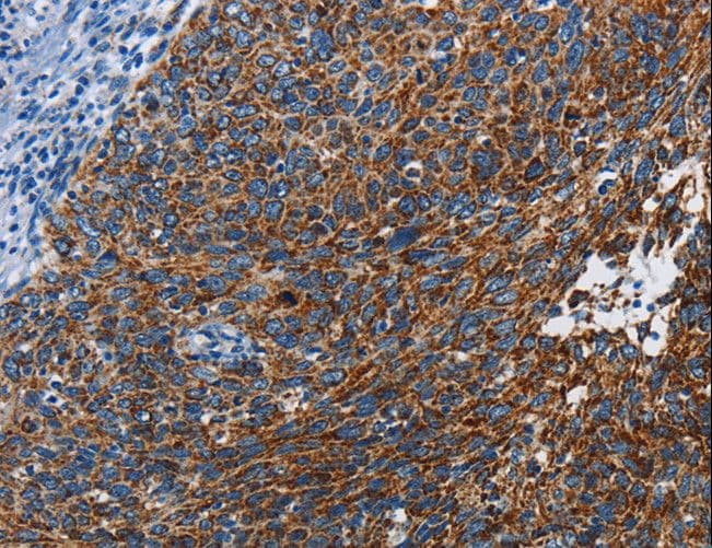 ETHE1 Antibody