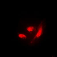 IRF3 Antibody (C-Terminus)