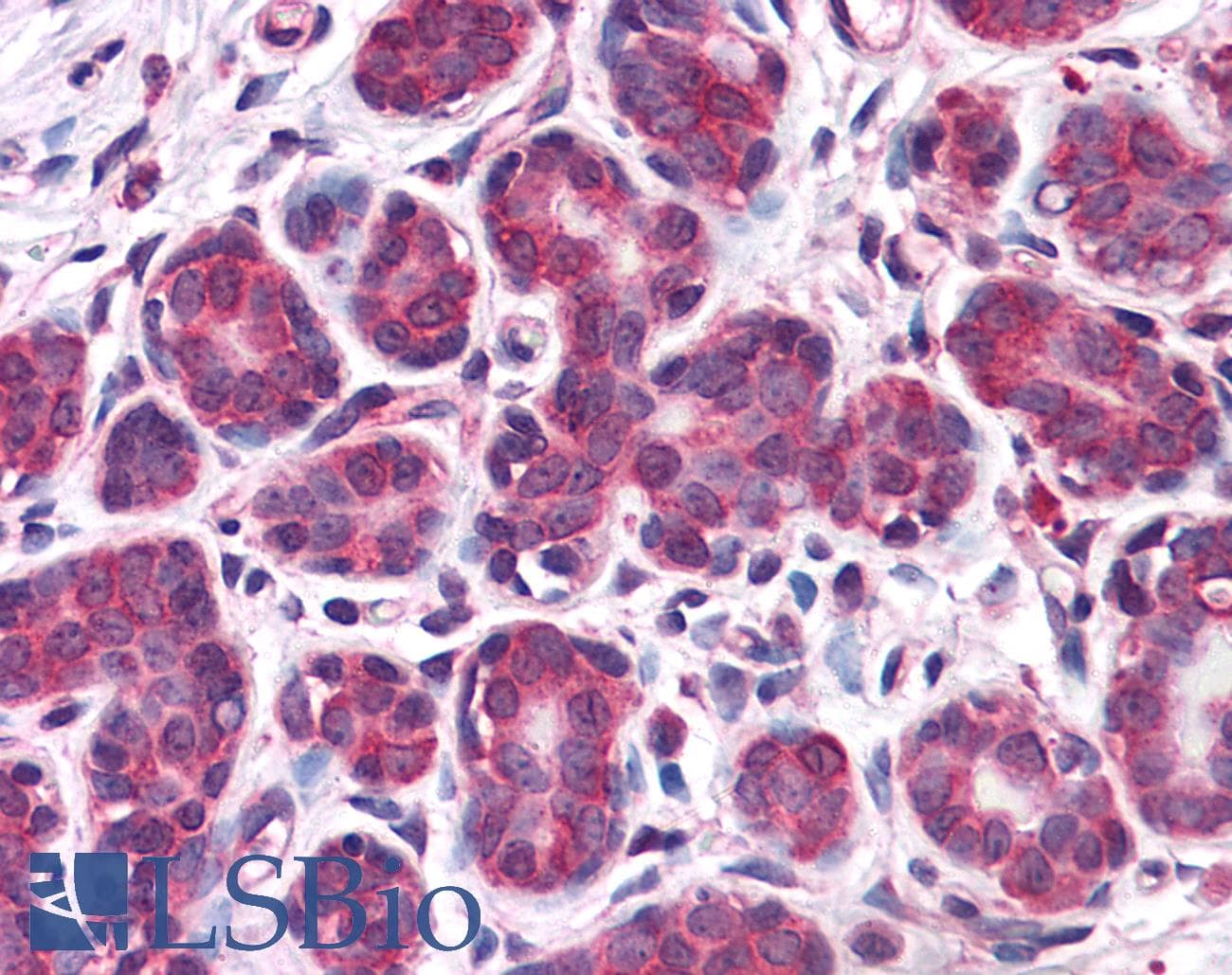 IHC-plus™ RBBP8 / CTIP Antibody