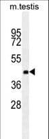 ZNF622 Antibody