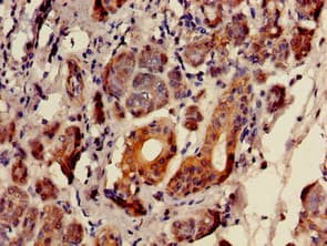 Polyclonal Rabbit anti-Human SULF2 / Sulfatase 2 Antibody (IHC, IF, WB)