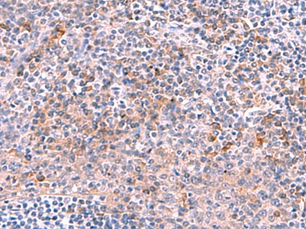 NCAN / Neurocan Antibody