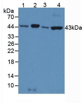 ACTB / Beta Actin Antibody
