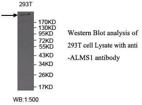ALMS1 Antibody (C-Terminus)