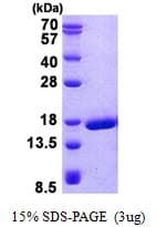 Human PRND / DOPPEL Protein (Recombinant His)