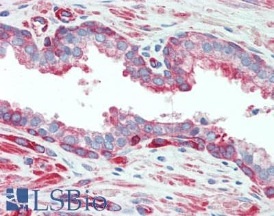 MYL12A / MRCL3 Antibody (aa10-171)