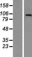 HDAC7 Protein (Over-Expression Lysate Myc-DDK (Flag))