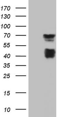 MSLN / Mesothelin Antibody (aa270-493, clone OTI1B7)
