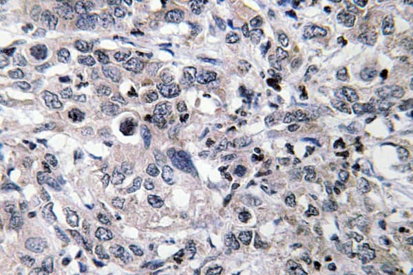 CYP2C19 Antibody (Lys270)