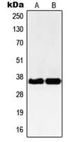 NBPF12 Antibody (C-Terminus)