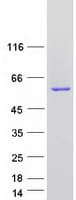 Human ACCS / ACS Protein (Recombinant Myc-DDK (Flag))