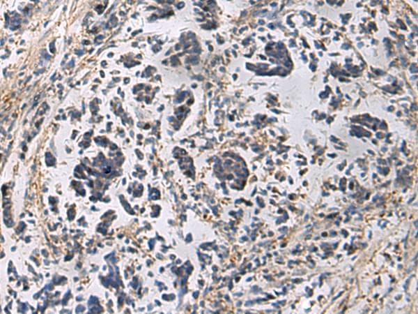 GRIK2 / GLUR6 Antibody