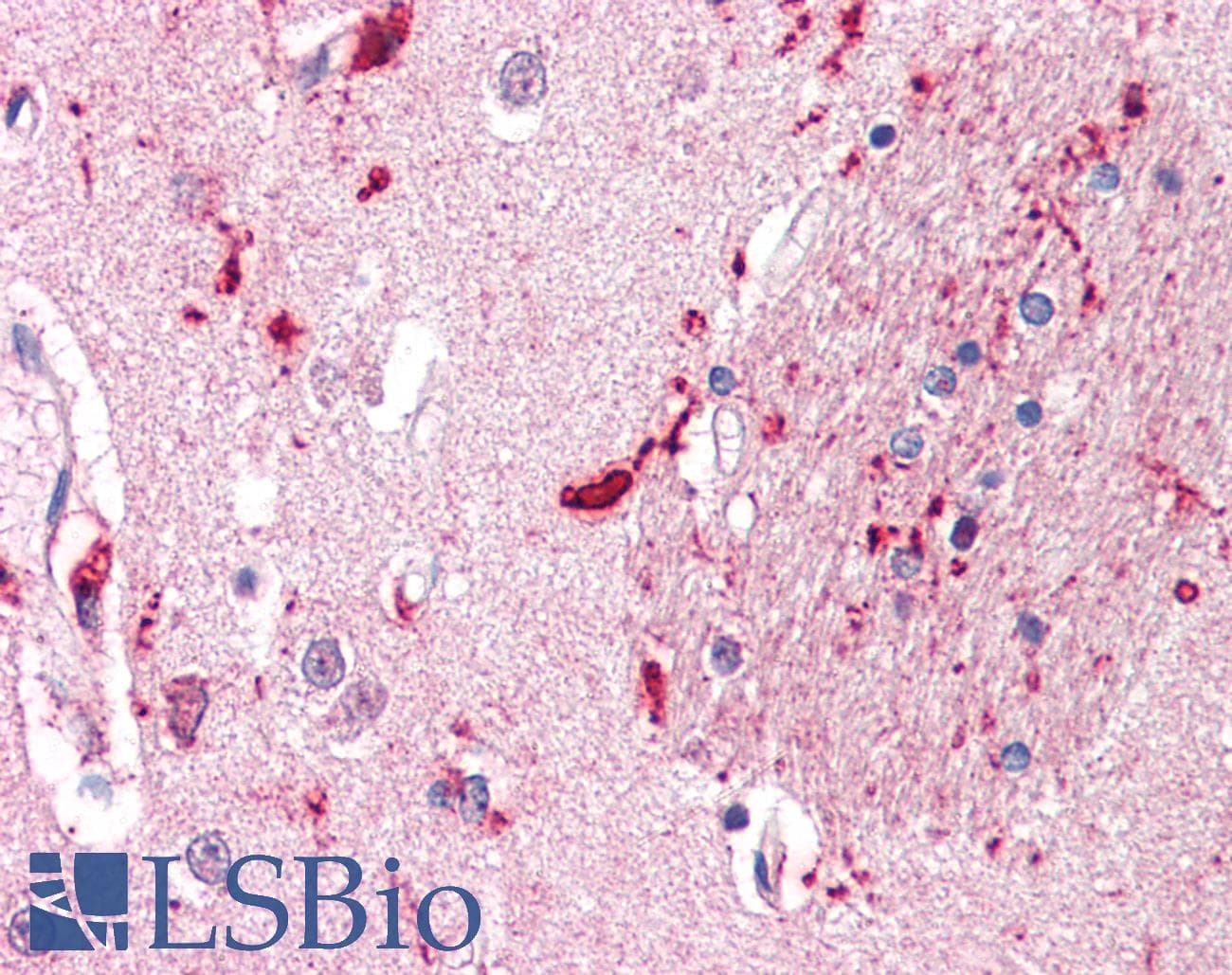 IHC-plus™ CD316 / IGSF8 Antibody (Internal)