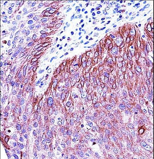 KRT6B / CK6B / Cytokeratin 6B Antibody (aa207-236)