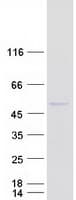Human NUP43 Protein (Recombinant Myc-DDK (Flag))
