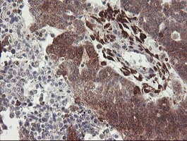 RFXANK Antibody (clone OTI3F5)