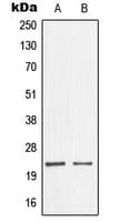 NME1 / NM23 Antibody (Internal)