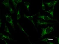 Monoclonal Mouse anti-Human PAX8 Antibody (clone PAX8R1, IF, WB)