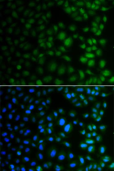 NAA40 Antibody