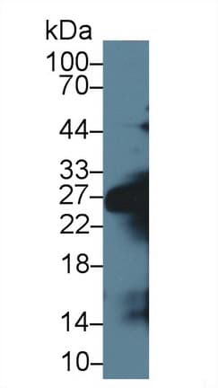 CELA1 / Pancreatic Elastase 1 Antibody (aa44-259, APC)