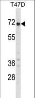 GPC2 / Glypican 2 Antibody (aa137-165)