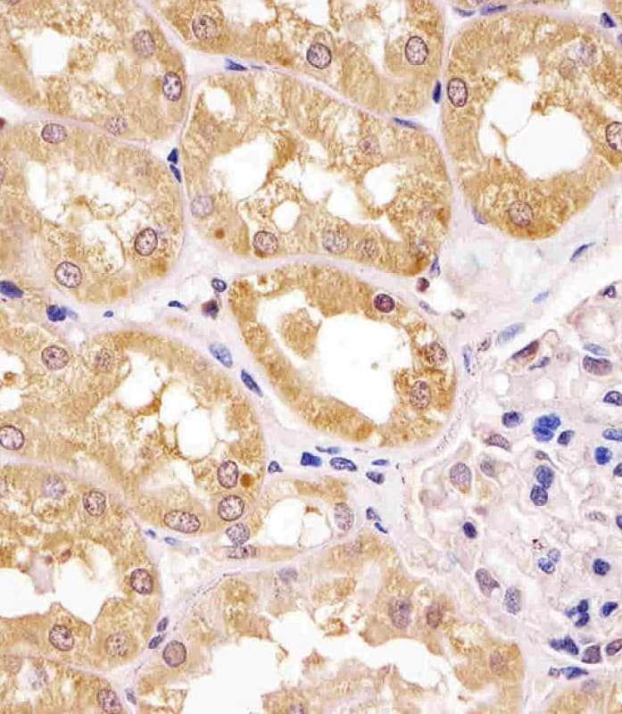 APIP Antibody (Internal)