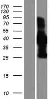 TACC1 Protein (Over-Expression Lysate Myc-DDK (Flag))