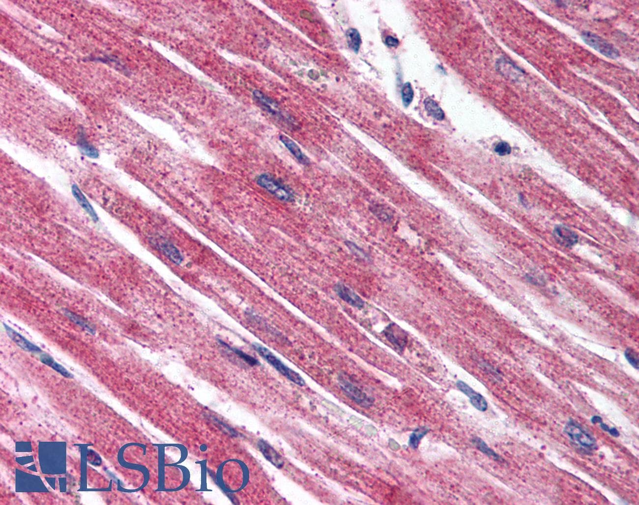 IHC-plus™ EDNRA / Endothelin A Receptor Antibody (Extracellular Domain)