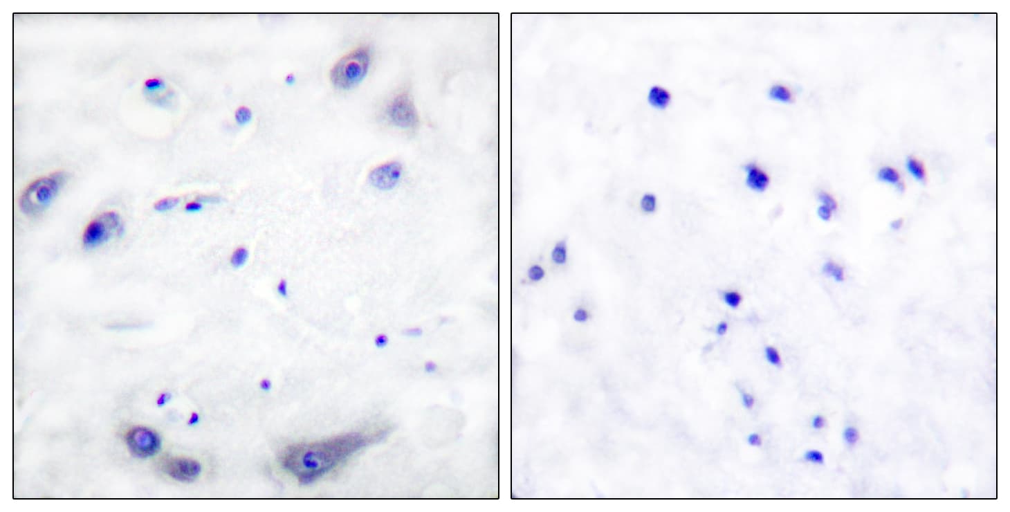 TH / Tyrosine Hydroxylase Antibody (aa1-50)