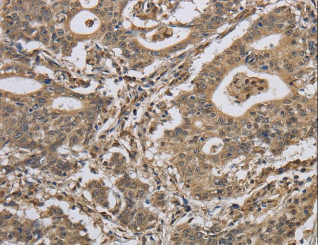 IPO7 / RANBP7 Antibody