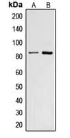 Polyclonal Rabbit anti-Human CNGA2 Antibody (Internal, WB)