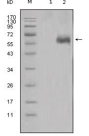 DKK1 Antibody (clone 2H2)