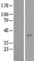 SPATA17 / IQCH Protein (Over-Expression Lysate Myc-DDK (Flag))